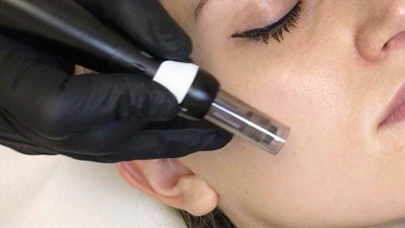 Maquillage permanent Microneedling soins du visage