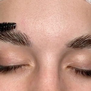 Formation Brow Lift