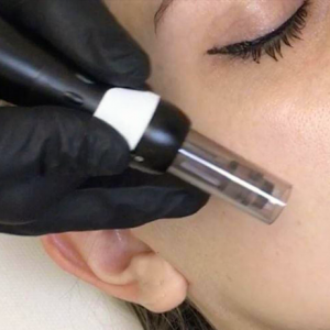 Formation Microneedling