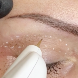 Formation Plasma lift