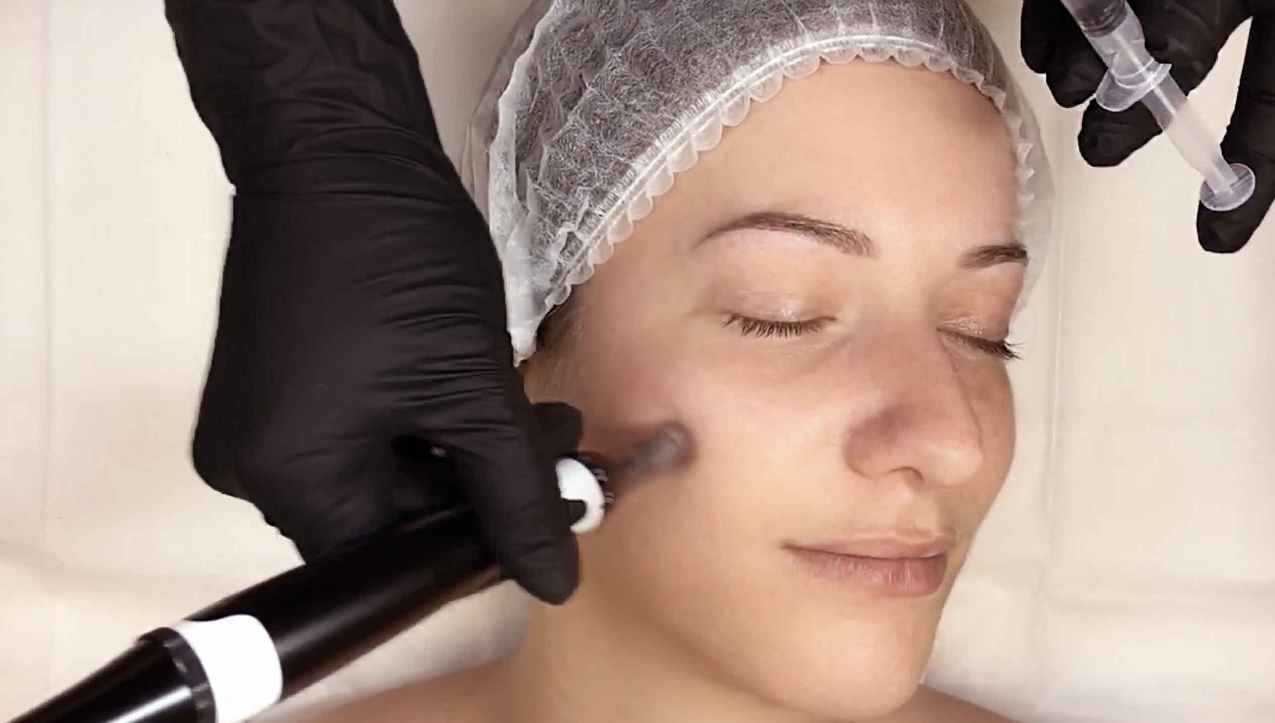 Formation-Microneedling